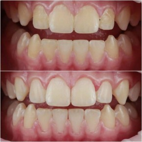 ���������� ���� �����: ��� ������ ����� �������� �������� ����� ������