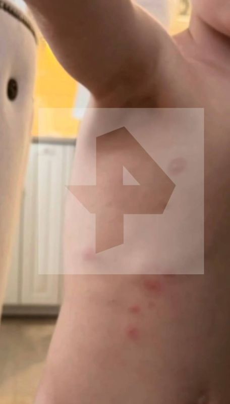 Жительница Сочи связала болезни ребенка с насекомыми в арендованной квартире Жительница Сочи связала болезни ребенка с насекомыми в арендованной квартире